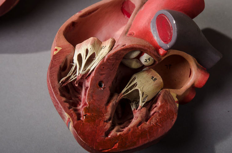 Picture of Lung Medical Model