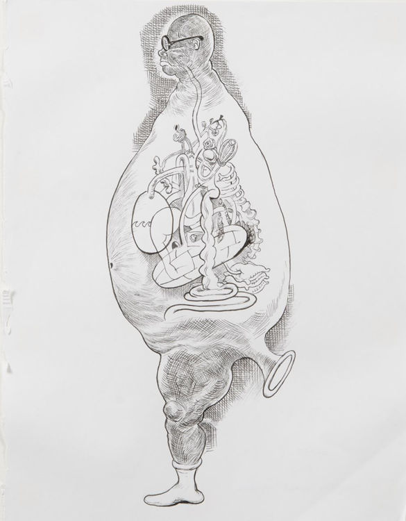 Picture of Bloat