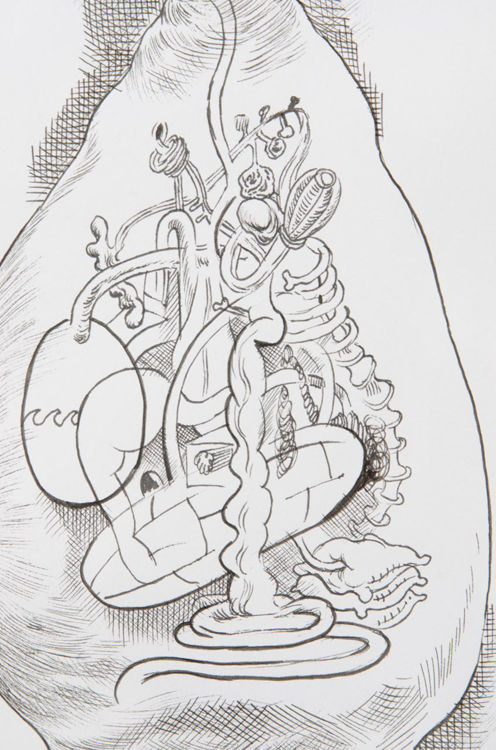 Picture of Bloat